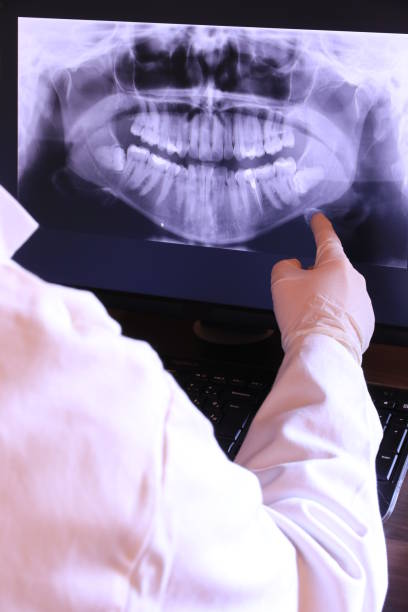 Best Emergency Dental Care for Broken or Chipped Teeth in Northlake, IL